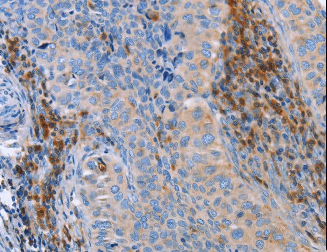 Polyclonal Rabbit anti-Human PLK3 Antibody (IHC)