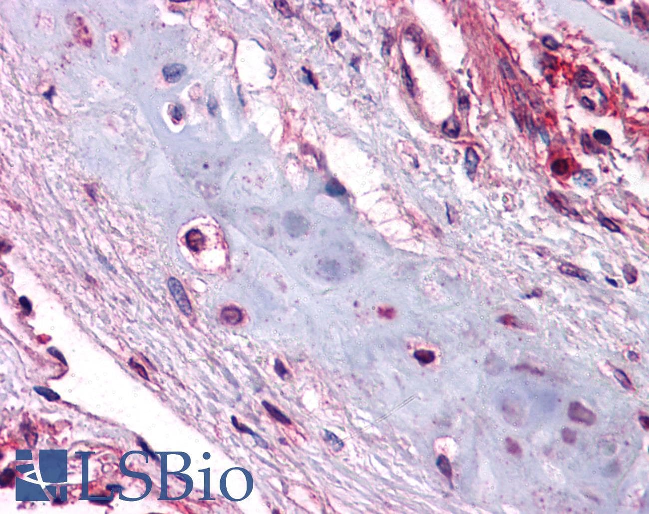 IHC-plus™ Polyclonal Rabbit anti-Human UCMA / GRP Antibody (IHC, WB)