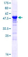 Human PSME3 Protein (Recombinant GST)