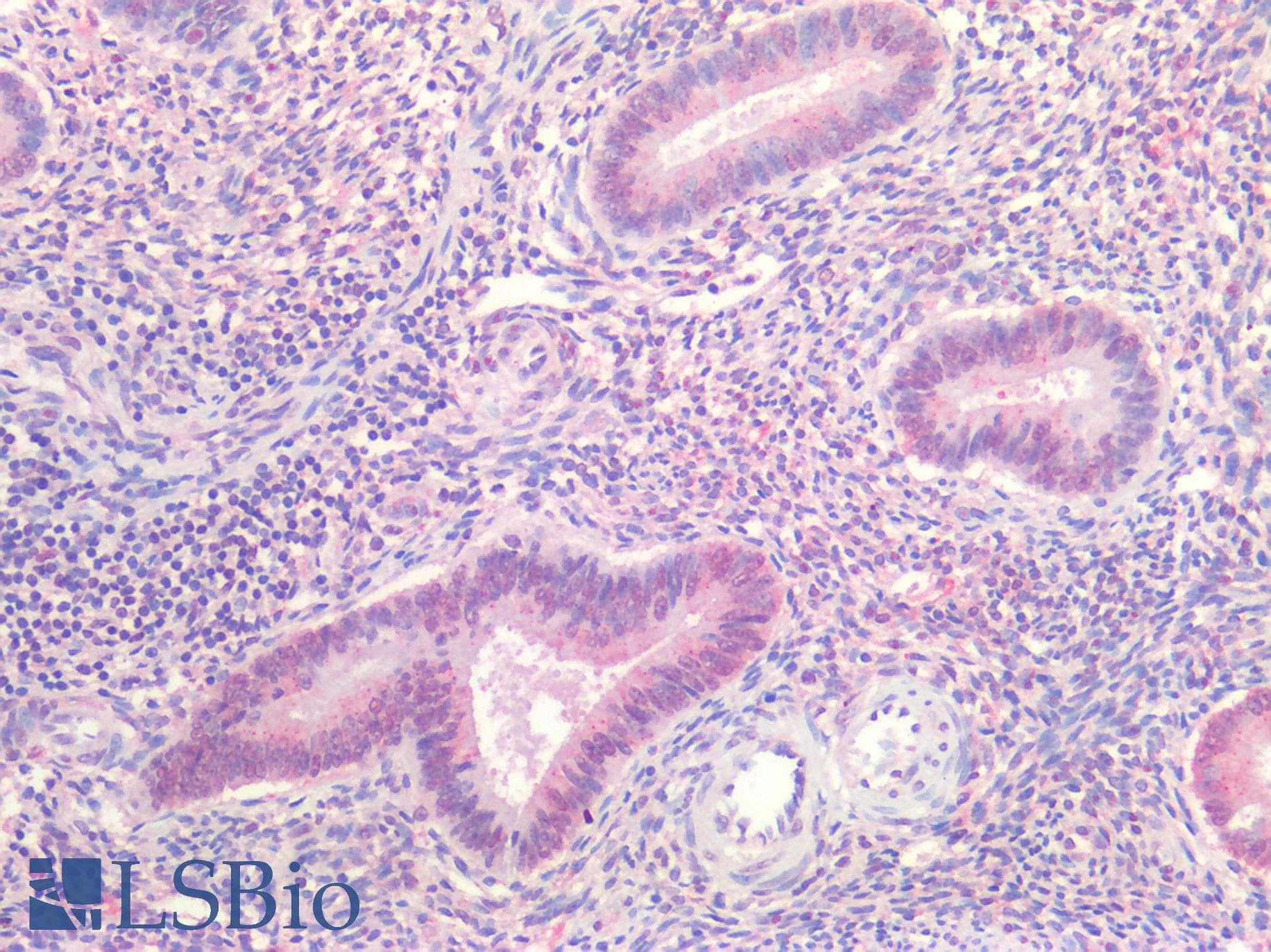 PathPlus™ DNMT / DNMT1 Antibody (aa891-904)