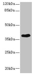 Polyclonal Rabbit anti-Human CAB39L Antibody (WB)