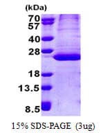 Human DESI1 / PPPDE2 Protein (Recombinant His)