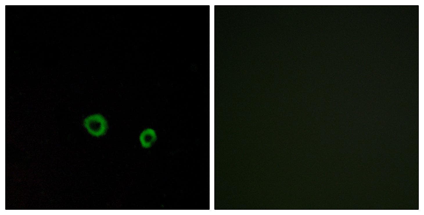 TAS2R10 / TRB2 Antibody