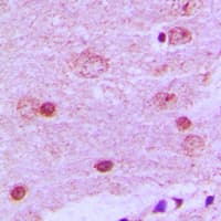 PAK7/PAK5 Antibody (C-Terminus)