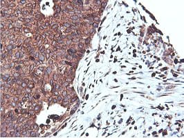 Monoclonal Mouse anti-Human APMAP / C20orf3 Antibody (clone 4F6, Carrier-free, IHC, WB)