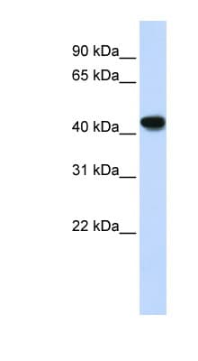 ADH2 / ADH1B Antibody (N-Terminus)