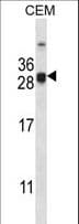 IHC-plus™ CIDEA / CIDE-A Antibody (aa181-209)