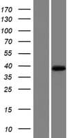 MOGAT1 / MGAT1 Protein (Over-Expression Lysate Myc-DDK (Flag))