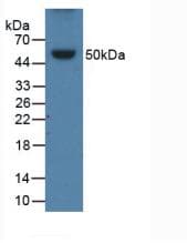 APOB / Apolipoprotein B Antibody (aa331-511)