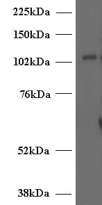 IHC-plus™ UNC13D Antibody (aa967-980)
