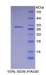 Human ITGAD / CD11d Protein (Recombinant His-T7)