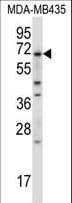 Polyclonal Rabbit anti-Human BIRC3 / cIAP2 Antibody (aa59-88, IHC, IF, WB)
