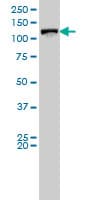 VCL / Vinculin Antibody (clone 2C6-1B5)