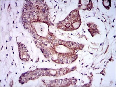 Monoclonal Mouse anti-Human ALK3 / BMPR1A Antibody (clone 4B7B2, Amino Acid: 179-378, IHC, WB)