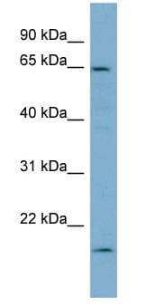 PLS3 / T Plastin Antibody (aa503-552)