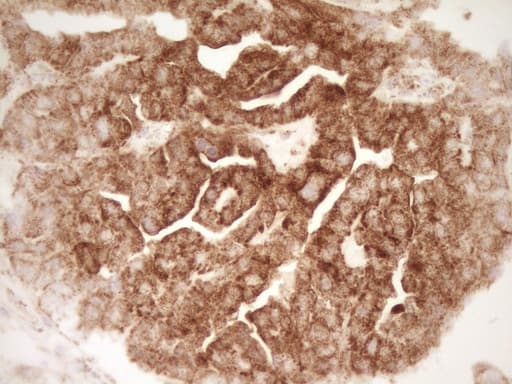 SFRP2 Antibody (aa25-295, clone OTI6C2)