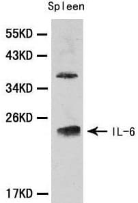 IL6 / Interleukin 6 Antibody