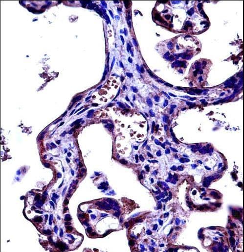Polyclonal Rabbit anti-Human ADGRE5 / CD97 Antibody (aa707-736, IHC, WB)