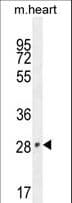 Polyclonal Rabbit anti-Human VGLL2 Antibody (aa49-77, WB)