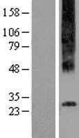 ADGRG3 / GPR97 Protein (Over-Expression Lysate Myc-DDK (Flag))