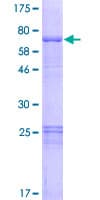 Human OSGEPL1 Protein (Recombinant GST)