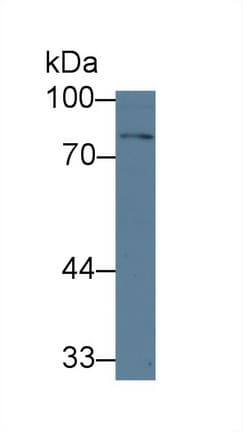 TGFBR2 Antibody (aa209-590, APC)
