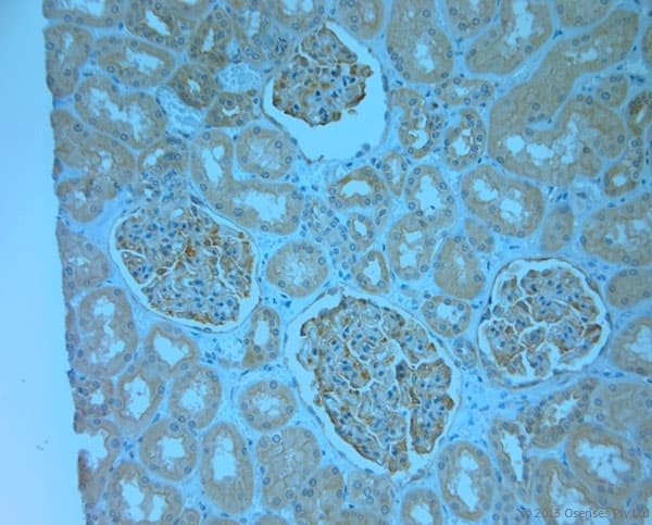 Polyclonal Rabbit anti-Human MPP1 Antibody (aa410-460, IHC)
