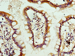 Polyclonal Rabbit anti-Human ALPL / Alkaline Phosphatase Antibody (aa20-270, IHC)