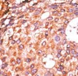 Polyclonal Rabbit anti-Human E2F1 Antibody (phospho-Ser337, IHC, WB)