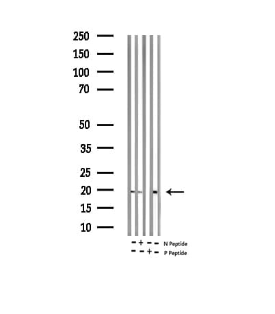 SNCA / Alpha-Synuclein Antibody (phospho-Ser129)