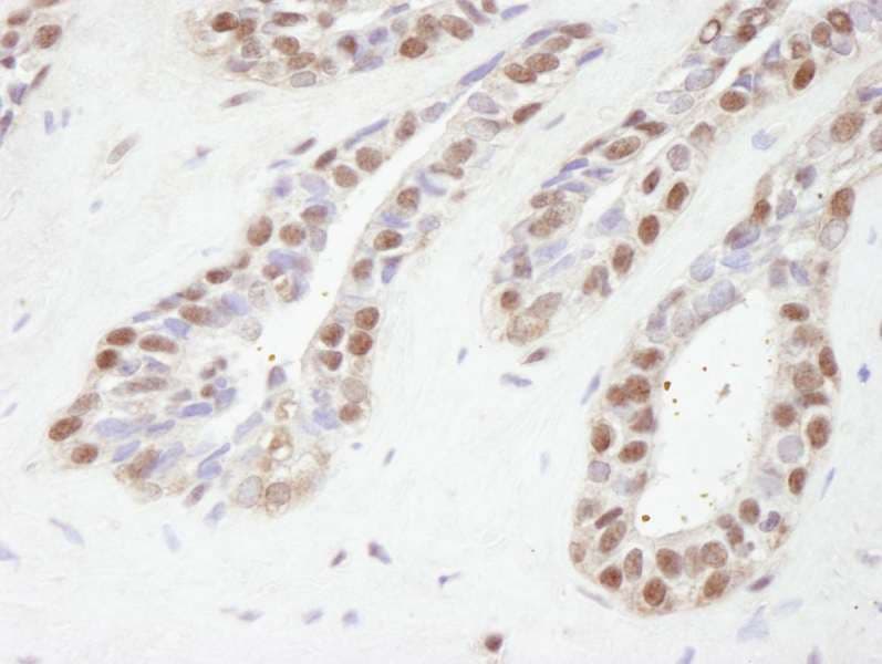 TBL1XR1 / TBLR1 Antibody (aa100-150)