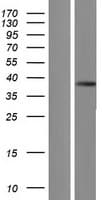 PRSS3 / Trypsin 3 Protein (Over-Expression Lysate Myc-DDK (Flag))