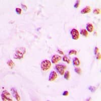IP6K2 Antibody (Internal)
