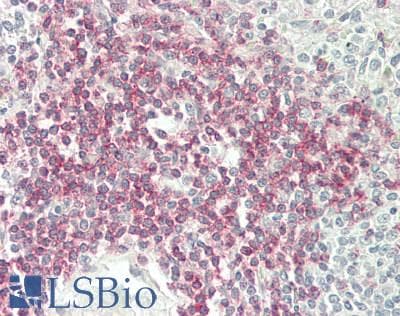 PathPlus™ CD4 Antibody (clone 7F2)