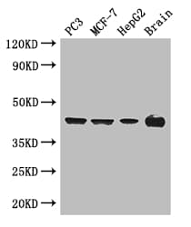 Polyclonal Rabbit anti-Human AMACR / P504S Antibody (IF, WB)