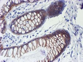 Monoclonal Mouse anti-Human ERBB2 / HER2 Antibody (clone OTI12G4, Carrier-free, aa676-1255, IHC, IF, WB)