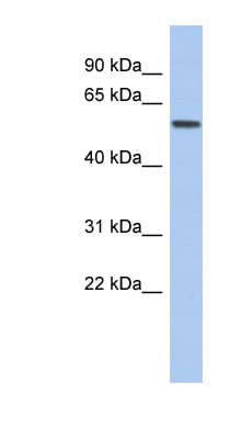 Polyclonal Rabbit anti-Human EBF2 Antibody (aa359-408, WB)
