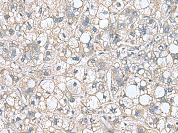 RHBDL2 / RRP2 Antibody