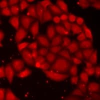 PIP4K2A / PIPK Antibody