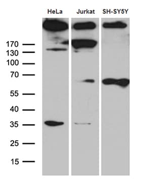 SPTAN1 / Alpha Fodrin Antibody (aa1-147, clone OTI9C10)