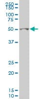Monoclonal Mouse anti-Human GCM1 Antibody (clone 2E11, IF, WB)