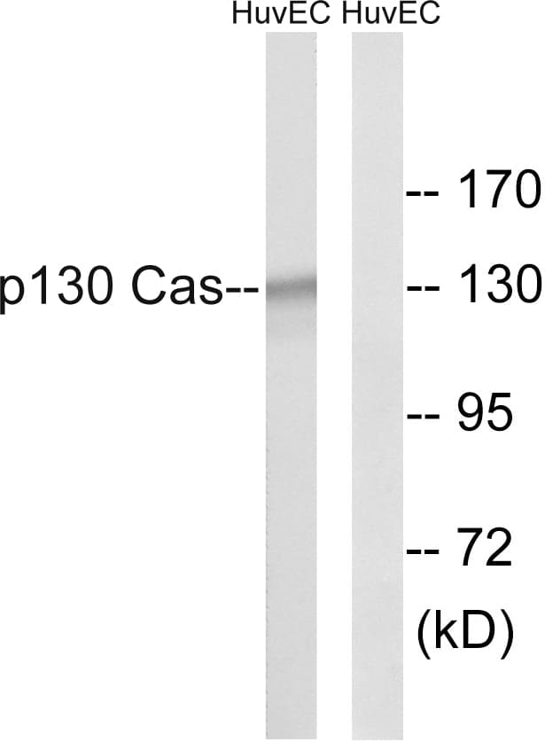 Polyclonal Rabbit anti-Human BCAR1 / p130Cas Antibody (aa376-425, IHC, WB)