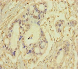 SRPK3 / MSSK1 Antibody