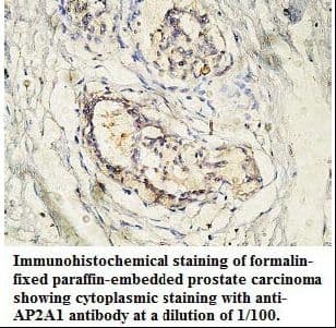 Polyclonal Rabbit anti-Human AP2A1 / AP2-Alpha Antibody (aa22-199, IHC, WB)