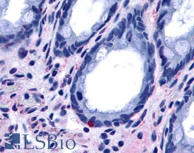 PathPlus™ Polyclonal Rabbit anti-Human BOB / GPR15 Antibody (C-Terminus, IHC)