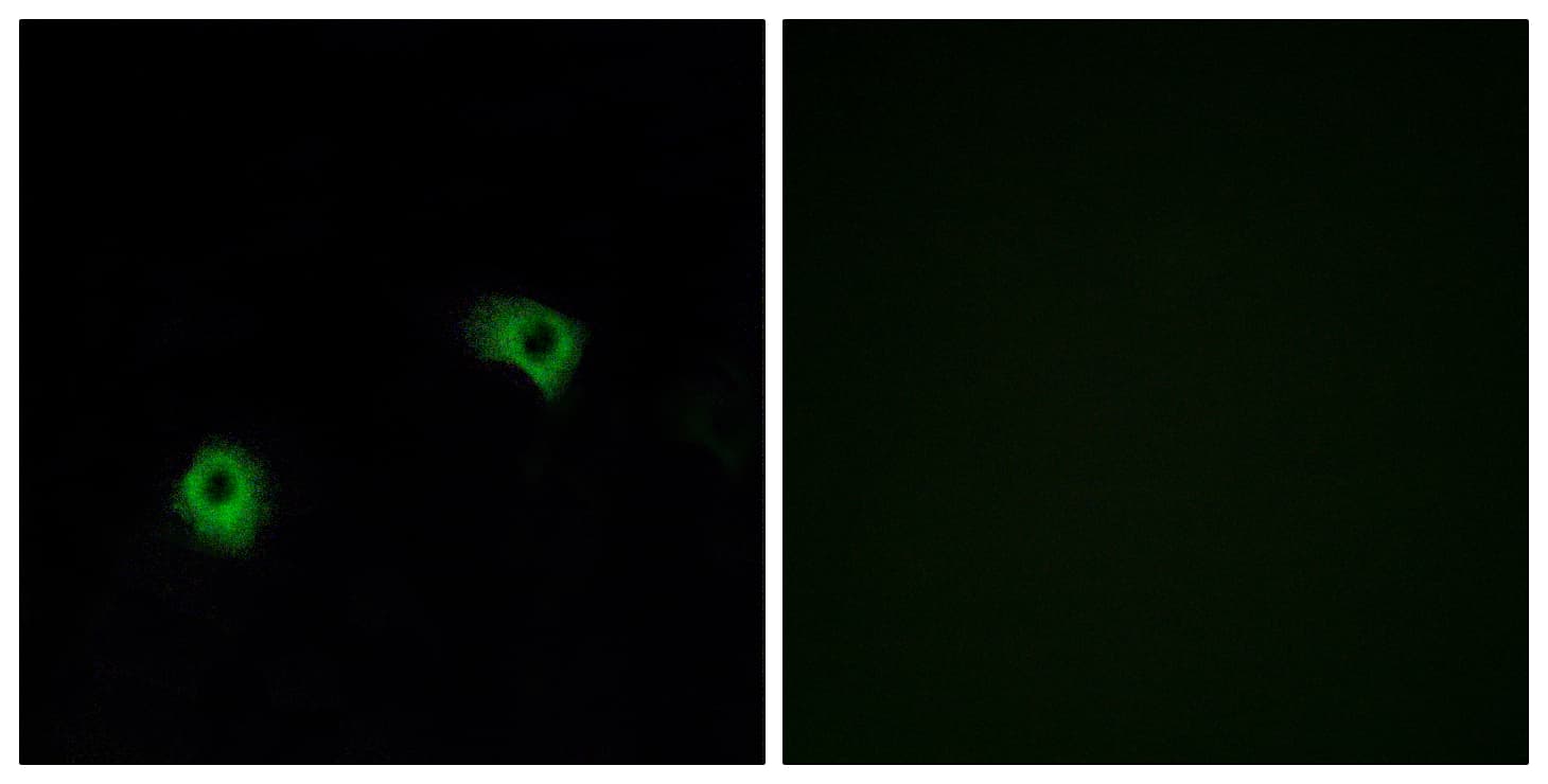 ADGRF5 / GPR116 Antibody (aa1121-1170)