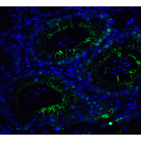 IHC-plus™ Polyclonal Rabbit anti-Human SMARCA4 / BRG1 Antibody (aa1420-1470, IHC, IF, WB)