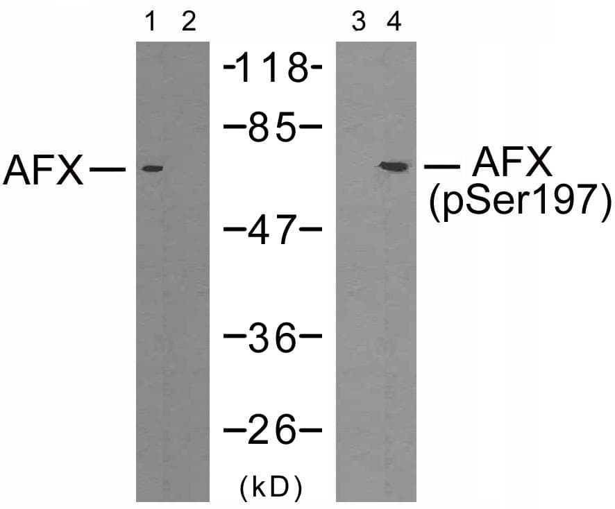 FOXO4 / AFX1 Antibody (p197)