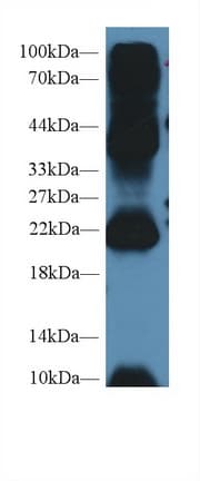 AGR2 Antibody (aa21-175, APC)