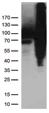 TGM2 / Transglutaminase 2 Antibody (clone OTI2F9)